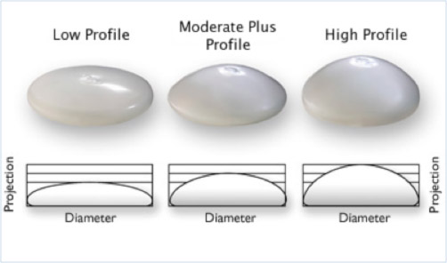 Silicone Diagram