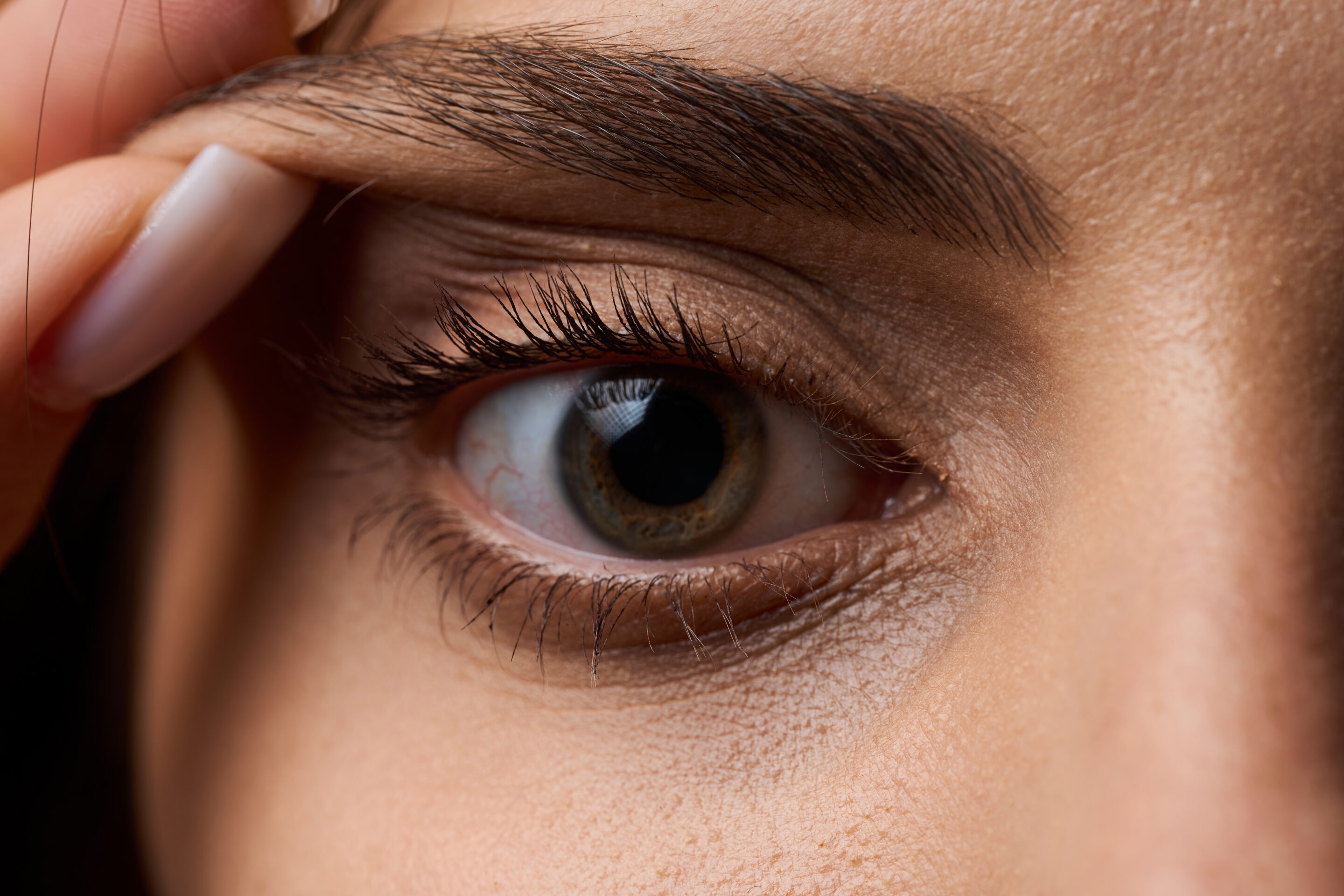eyelid-lift